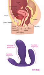 Remote Control Prostate & G-Spot Vibrator – Triple Stimulation, 7 Modes, Ultra-Quiet & Waterproof